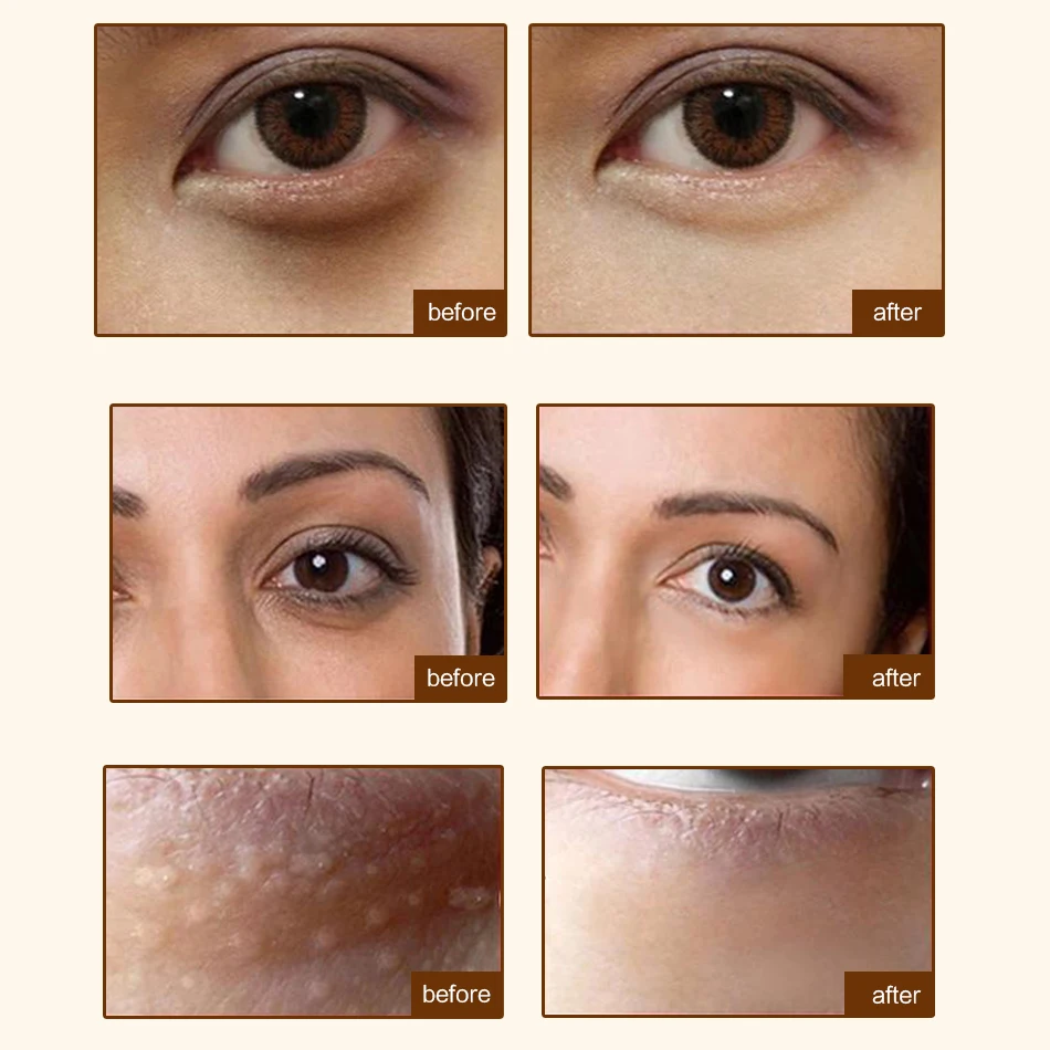 Creme De Ochi Pentru Femei - Bioliq 35+ tratament pentru ochi umflati