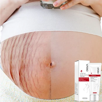 Sfaturi Sarcina Siguranta Piele: cele mai bune produse de îngrijire a pielii pentru femei gravide